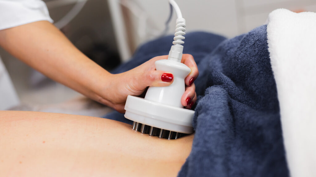 Radiofréquence et lipocavitation à Aubagne Marseille